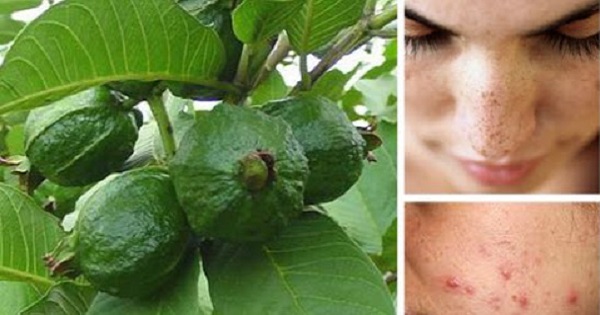 para que es buena la hoja guayaba para que es buena la hoja guayaba