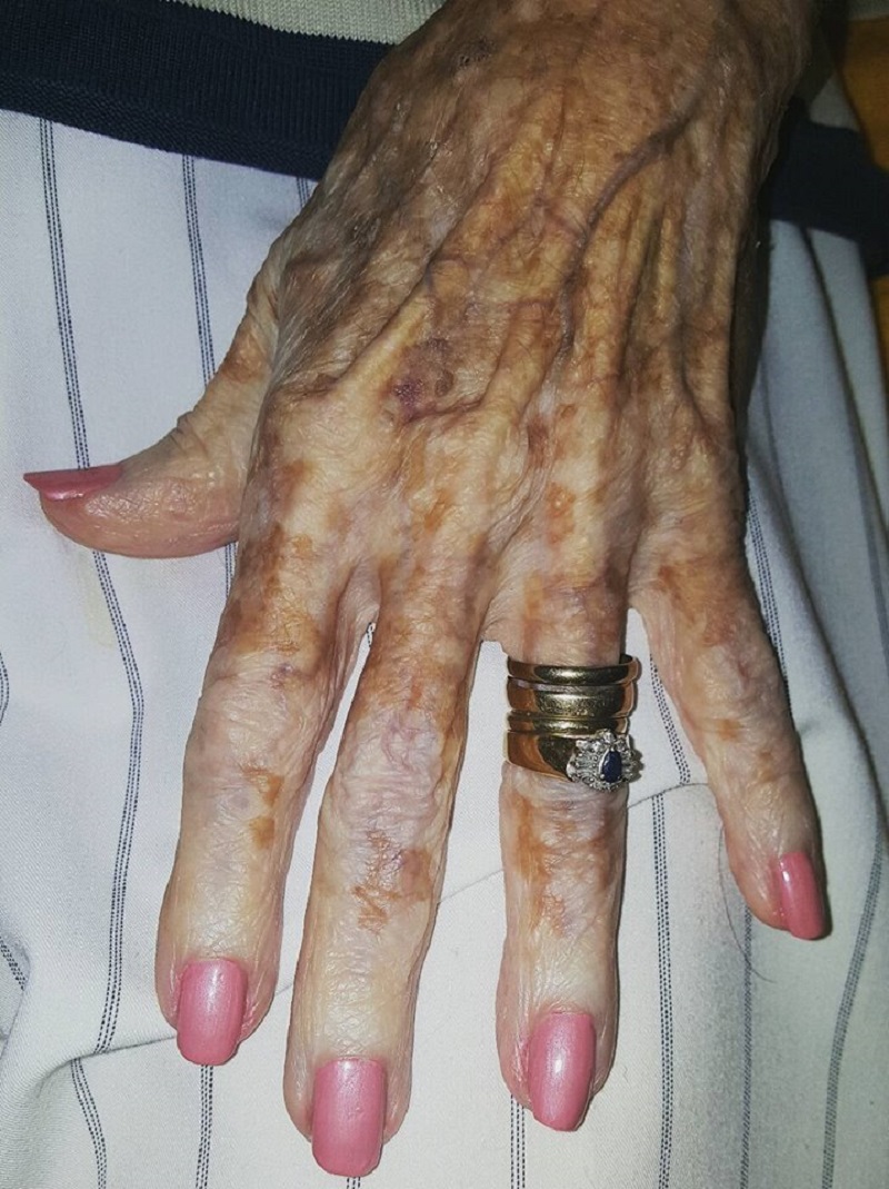 Enfermera le pinta las uñas a la anciana